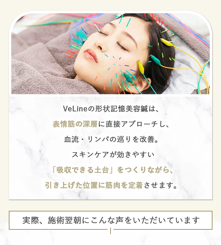 VeLineの形状記憶美容鍼は、表情筋の深層に直接アプローチし、血流・リンパの巡りを改善。